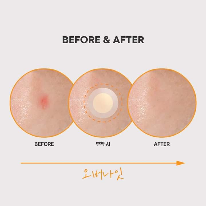 스팟 이레이저 오렌지 3단계(12개)